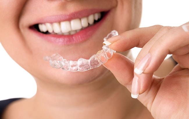  Niềng răng không mắc cài – Invisalign