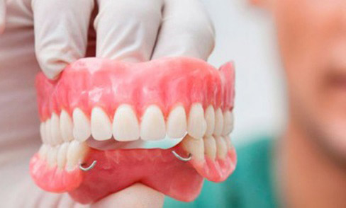  Răng giả tháo lắp