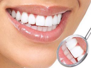 Giữ trắng răng sau tẩy trắng răng